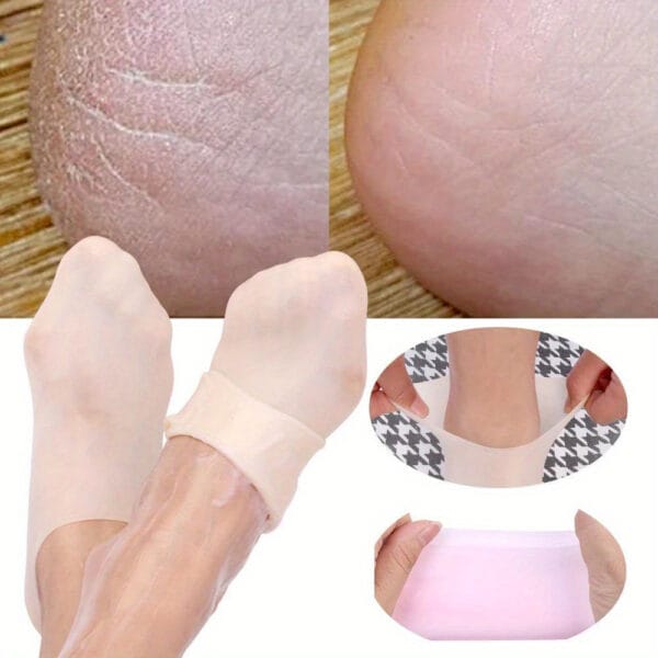 Silicone Moisturizing Gel Socks For Cracked Feet - Image 8
