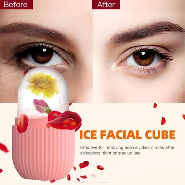 Multi-Purpose Silicone Facial Ice Roller - Image 2