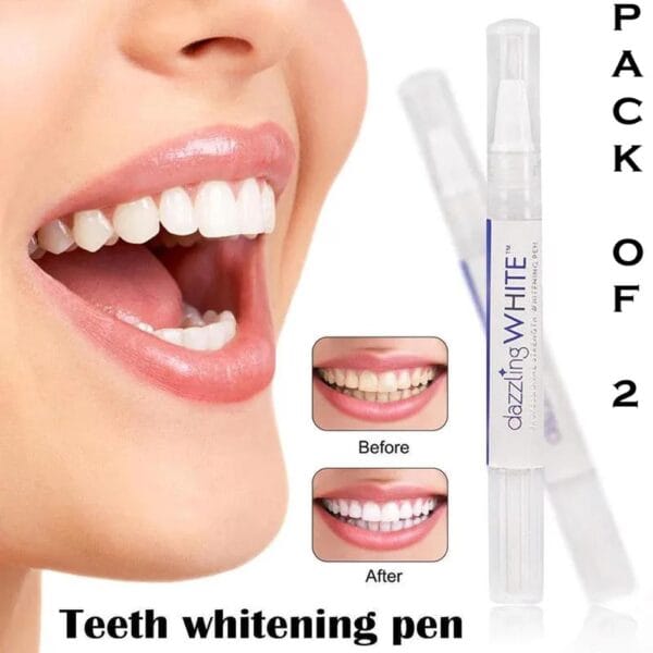 dazzling-white-teeth-whitening-pens